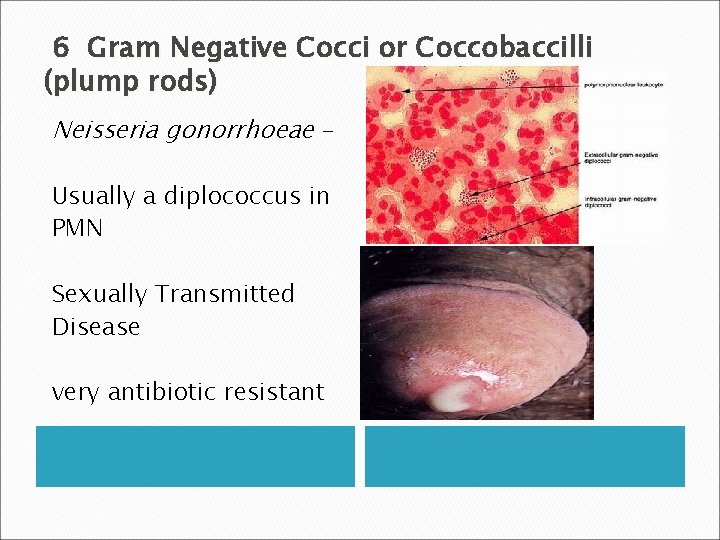 6 Gram Negative Cocci or Coccobaccilli (plump rods) Neisseria gonorrhoeae – Usually a diplococcus