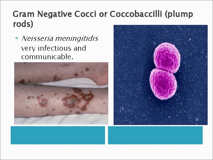 Gram Negative Cocci or Coccobaccilli (plump rods) Neisseria meningitidis very infectious and communicable. 