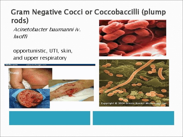 Gram Negative Cocci or Coccobaccilli (plump rods) Acinetobacter baumanni iv. lwoffi opportunistic, UTI, skin,