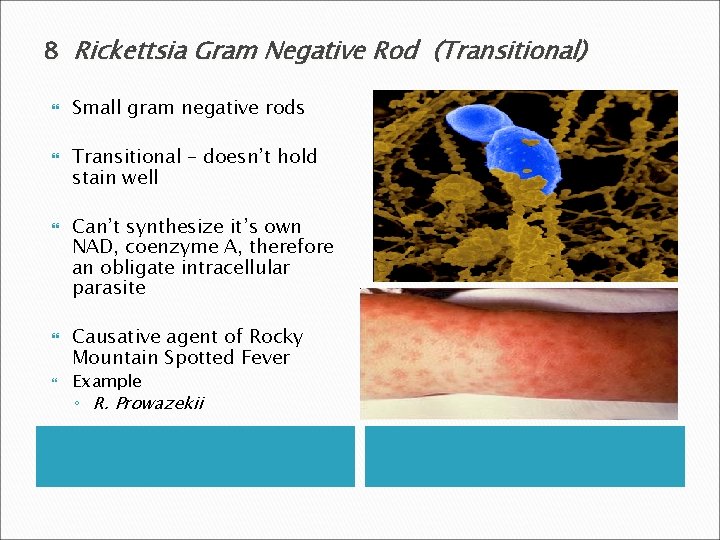 8 Rickettsia Gram Negative Rod (Transitional) Small gram negative rods Transitional – doesn’t hold