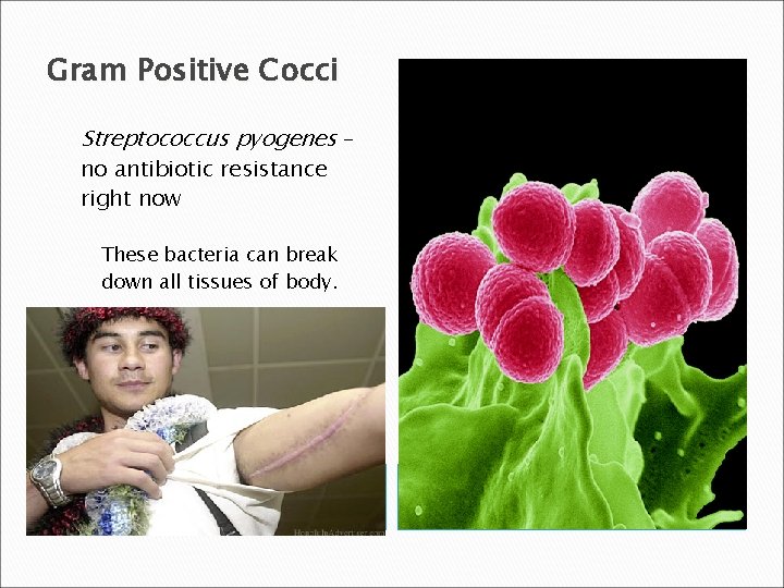Gram Positive Cocci Streptococcus pyogenes – no antibiotic resistance right now These bacteria can