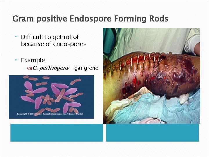 Gram positive Endospore Forming Rods Difficult to get rid of because of endospores Example