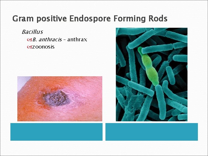 Gram positive Endospore Forming Rods Bacillus B. anthracis – anthrax zoonosis 