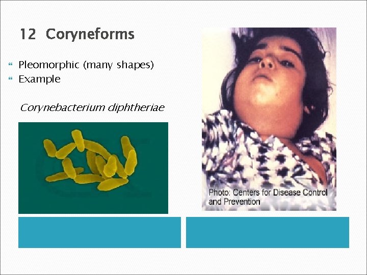 12 Coryneforms Pleomorphic (many shapes) Example Corynebacterium diphtheriae 