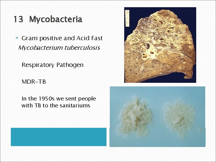 13 Mycobacteria Gram positive and Acid Fast Mycobacterium tuberculosis Respiratory Pathogen MDR-TB In the