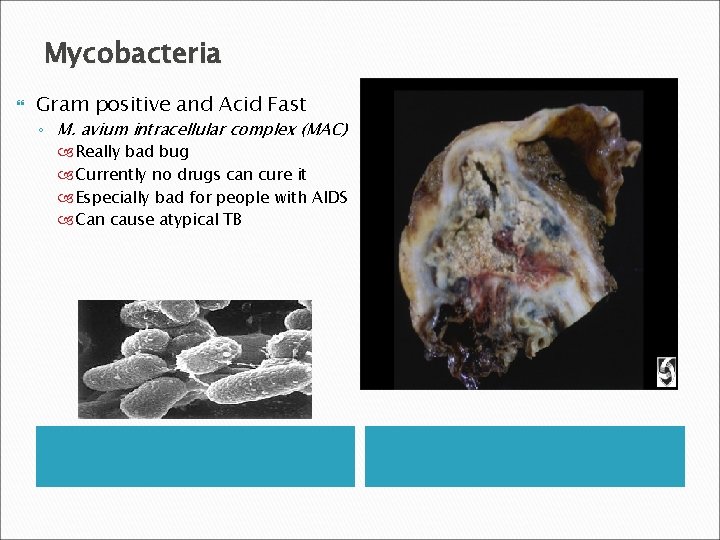 Mycobacteria Gram positive and Acid Fast ◦ M. avium intracellular complex (MAC) Really bad