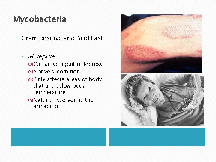Mycobacteria Gram positive and Acid Fast ◦ M. leprae Causative agent of leprosy Not