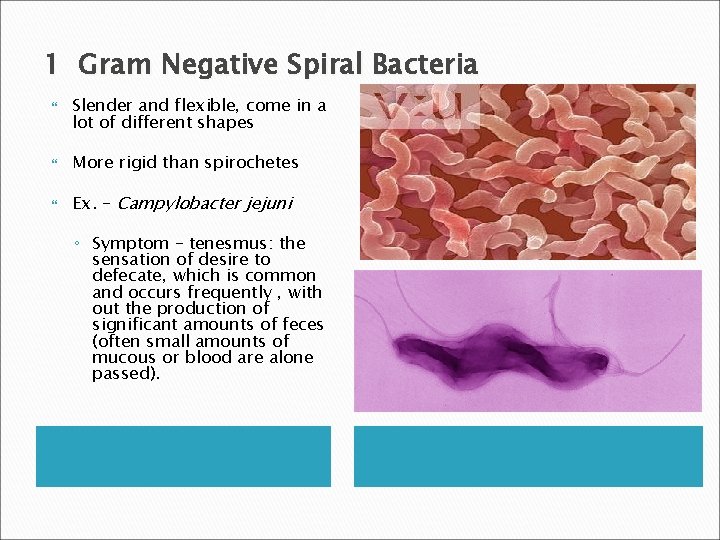 1 Gram Negative Spiral Bacteria Slender and flexible, come in a lot of different