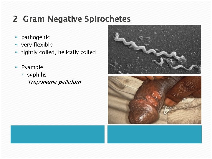 2 Gram Negative Spirochetes pathogenic very flexible tightly coiled, helically coiled Example ◦ syphilis