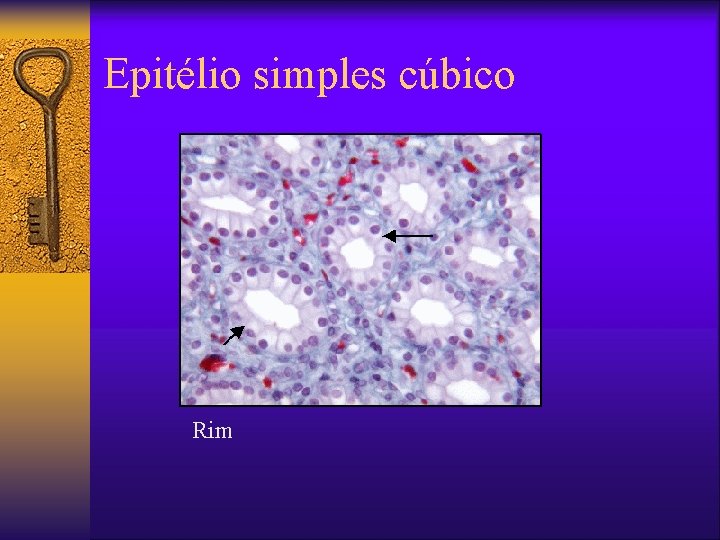 Epitélio simples cúbico ¨ Rim 