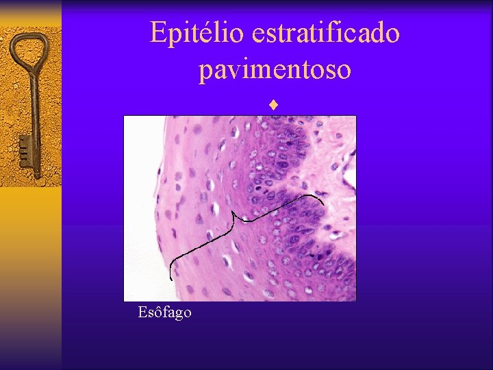 Epitélio estratificado pavimentoso ¨ Esôfago 