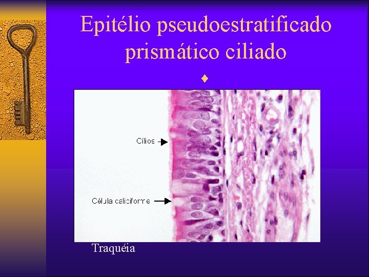Epitélio pseudoestratificado prismático ciliado ¨ Traquéia 