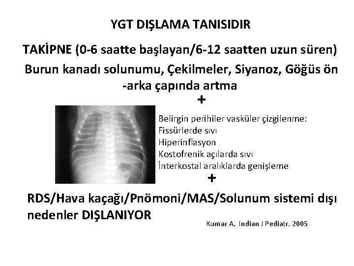  YGT DIŞLAMA TANISIDIR TAKİPNE (0 -6 saatte başlayan/6 -12 saatten uzun süren) Burun