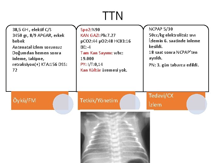 TTN 38, 5 GH , elektif C/S 3450 gr, 8/9 APGAR, erkek bebek Antenatal