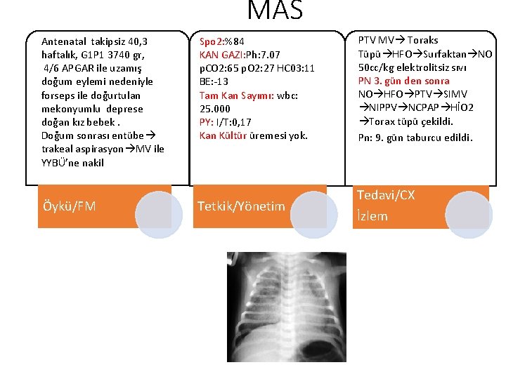 MAS Antenatal takipsiz 40, 3 haftalık, G 1 P 1 3740 gr, 4/6 APGAR