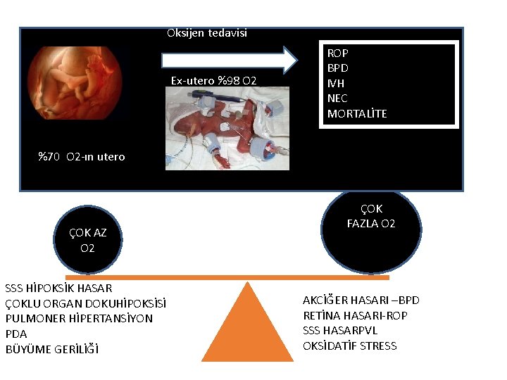 Oksijen tedavisi Ex-utero %98 O 2 ROP BPD IVH NEC MORTALİTE %70 O 2 Oksijen tedavisi Ex-utero %98 O 2 ROP BPD IVH NEC MORTALİTE %70 O 2