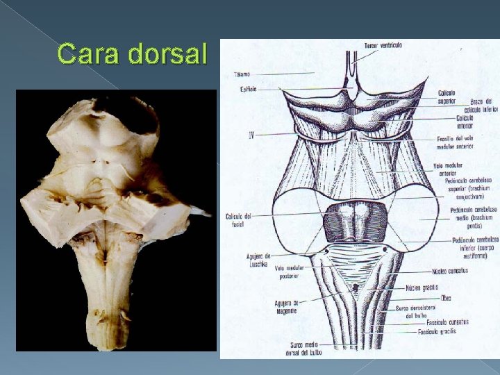 Cara dorsal 