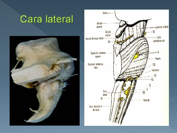 Cara lateral 