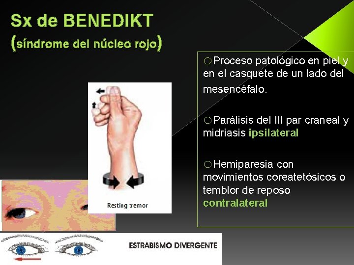 Sx de BENEDIKT (síndrome del núcleo rojo) o. Proceso patológico en piel y en