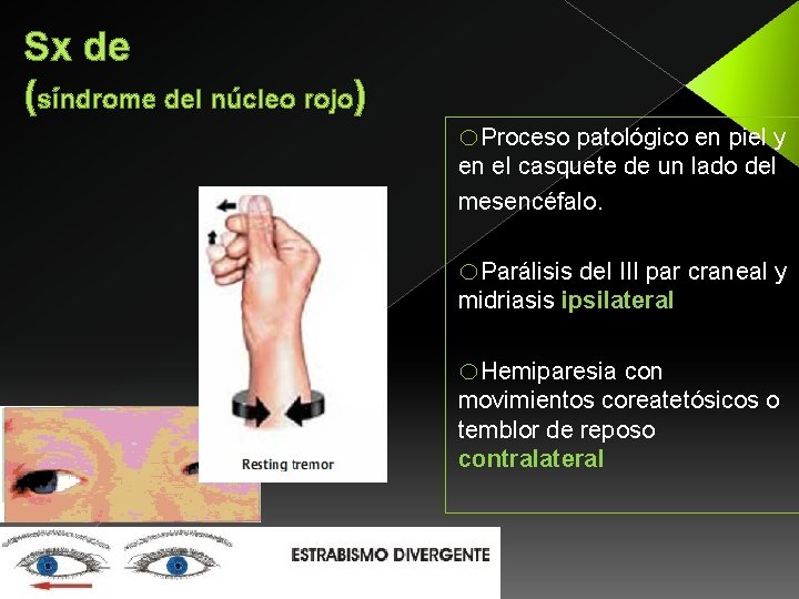 Sx de (síndrome del núcleo rojo) o. Proceso patológico en piel y en el