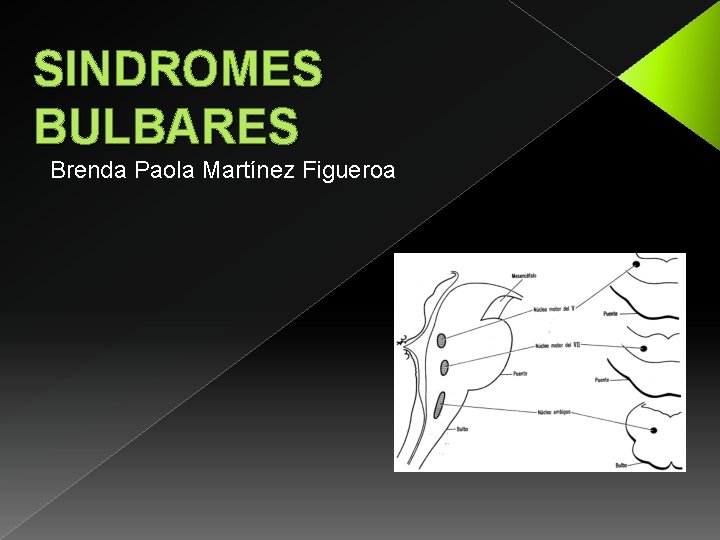 SINDROMES BULBARES Brenda Paola Martínez Figueroa 