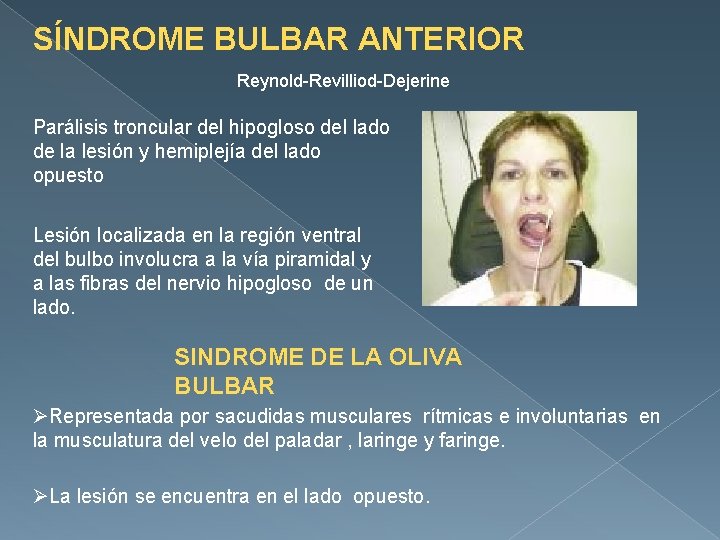 SÍNDROME BULBAR ANTERIOR Reynold-Revilliod-Dejerine Parálisis troncular del hipogloso del lado de la lesión y