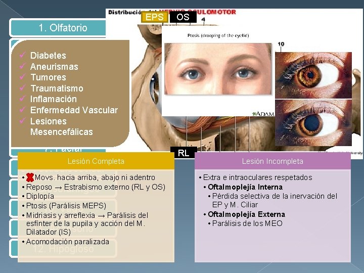 EPS OS 1. Olfatorio ü ü ü ü 2. Óptico Diabetes Aneurismas 3. Oculomotor