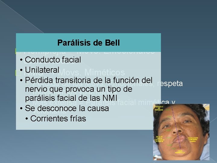 Parálisis de Bell � Hemiplejía = Movs. Emocionales • conservados Conducto facial Unilateral �