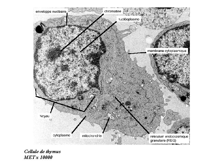 Cellule de thymus MET x 10000 