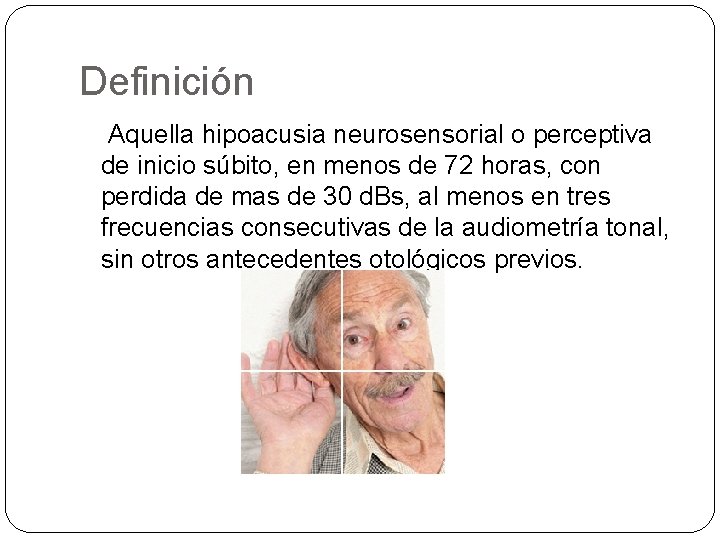 Definición Aquella hipoacusia neurosensorial o perceptiva de inicio súbito, en menos de 72 horas,