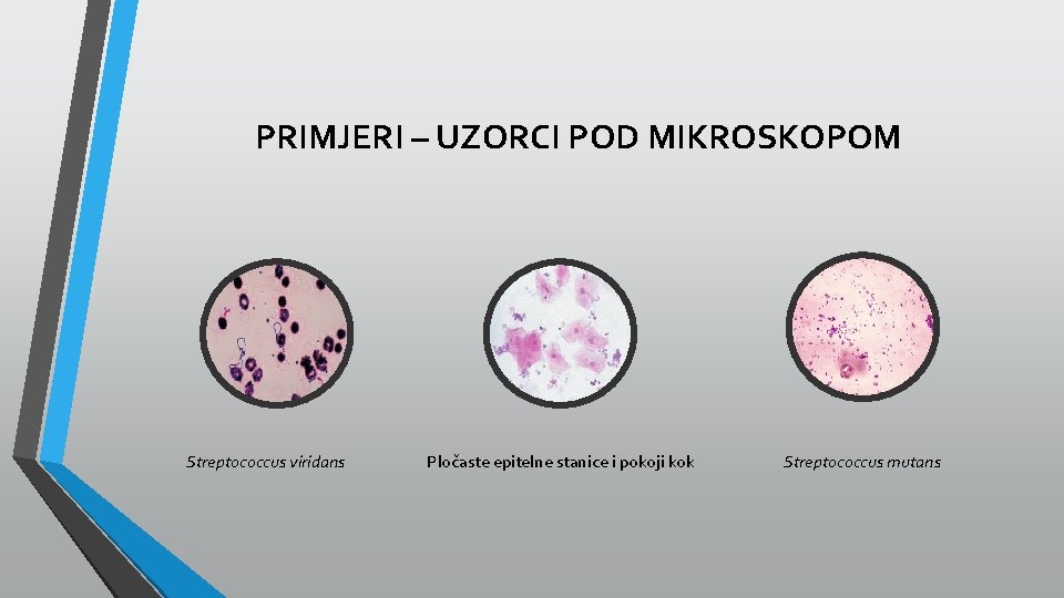 PRIMJERI – UZORCI POD MIKROSKOPOM Streptococcus viridans Pločaste epitelne stanice i pokoji kok Streptococcus