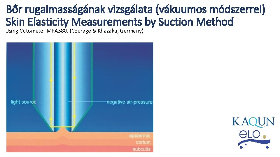 Bőr rugalmasságának vizsgálata (vákuumos módszerrel) Skin Elasticity Measurements by Suction Method Using Cutometer MPA