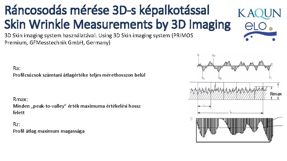 Ráncosodás mérése 3 D-s képalkotással Skin Wrinkle Measurements by 3 D Imaging 3 D