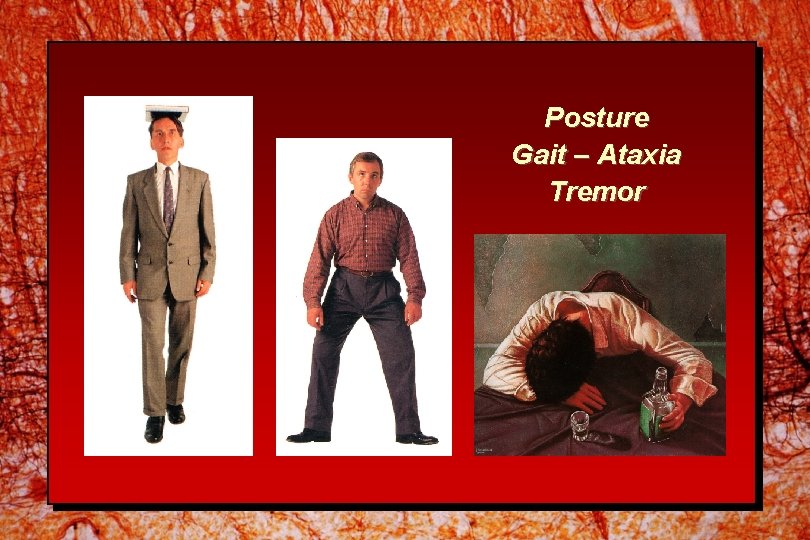 Posture Gait – Ataxia Tremor 