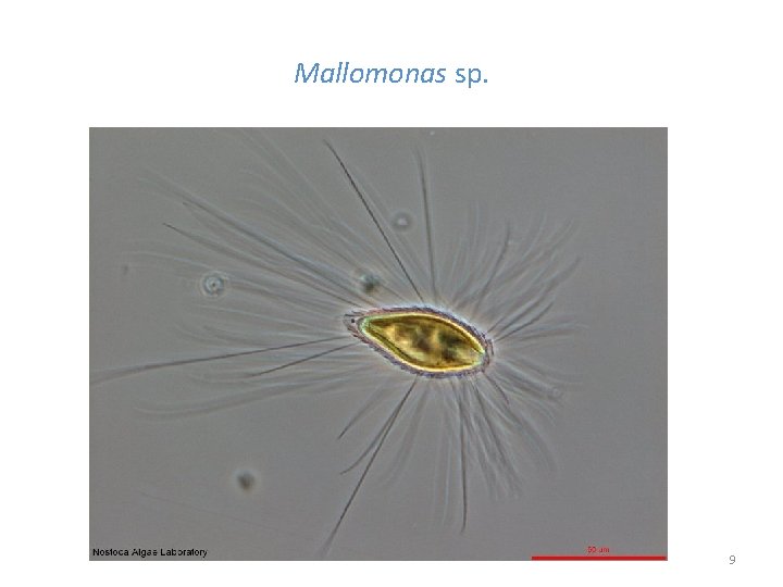 Mallomonas sp. 9 