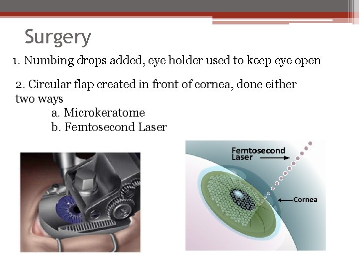 Surgery 1. Numbing drops added, eye holder used to keep eye open 2. Circular