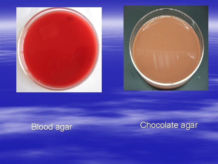Blood agar Chocolate agar 