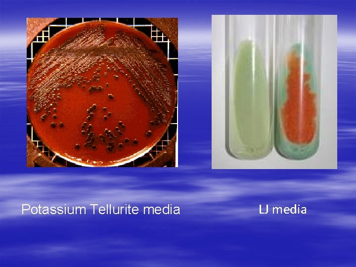 Potassium Tellurite media LJ media 