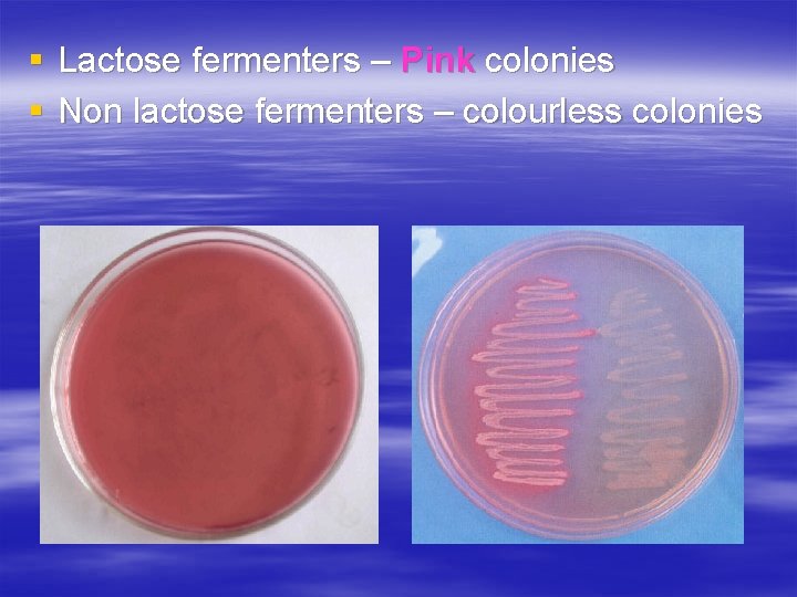 § Lactose fermenters – Pink colonies § Non lactose fermenters – colourless colonies 