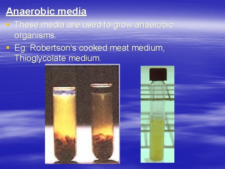 Anaerobic media § These media are used to grow anaerobic organisms. § Eg: Robertson’s