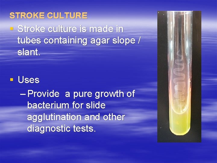 STROKE CULTURE § Stroke culture is made in tubes containing agar slope / slant.