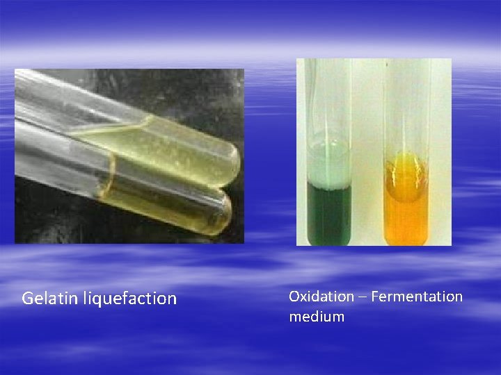 Gelatin liquefaction Oxidation – Fermentation medium 