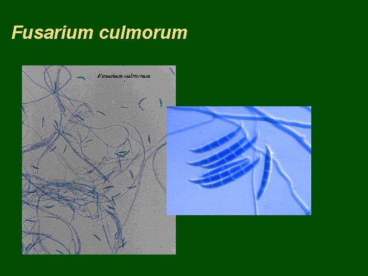 Fusarium culmorum 