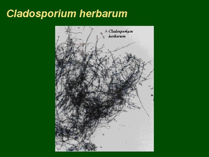 Cladosporium herbarum 