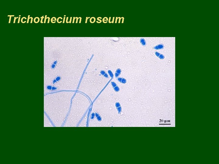 Trichothecium roseum 