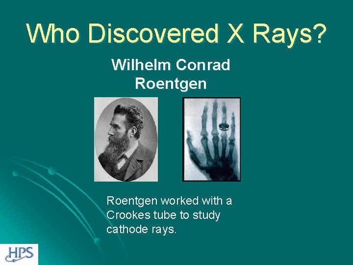 Who Discovered X Rays? Wilhelm Conrad Roentgen worked with a Crookes tube to study