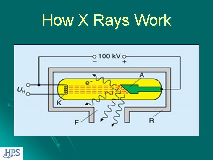 How X Rays Work 