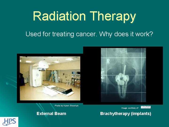 Radiation Therapy Used for treating cancer. Why does it work? Photo by Karen Sheehan