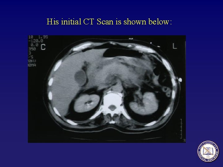 His initial CT Scan is shown below: 