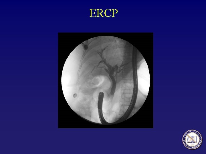 ERCP 